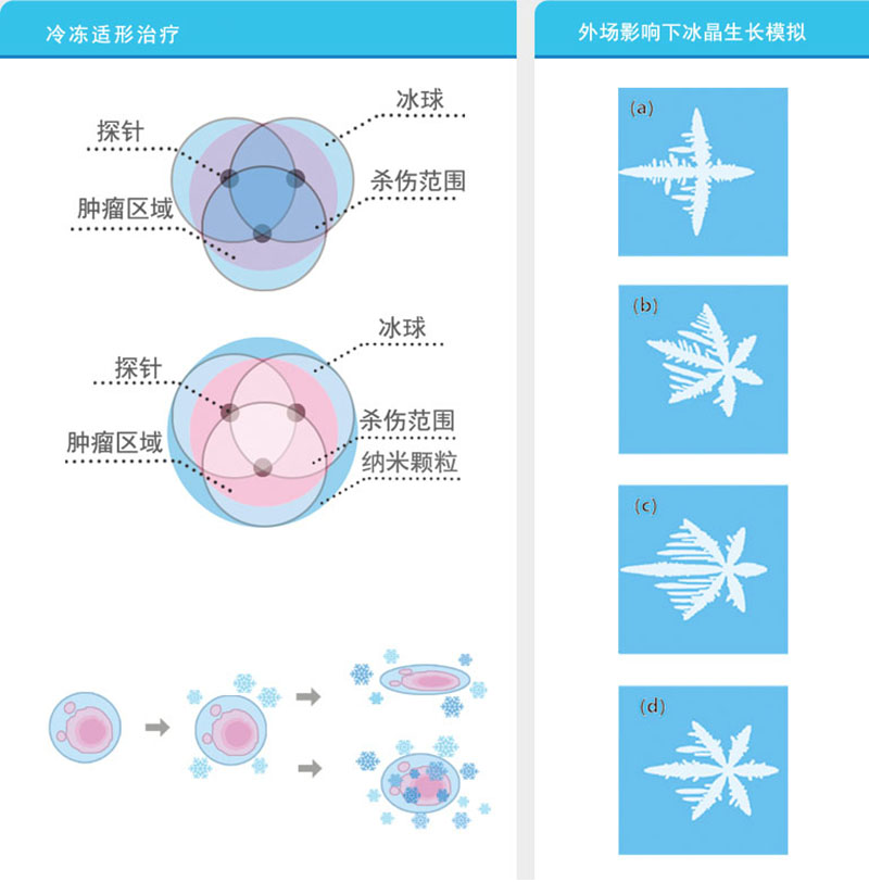 低溫冷凍治療系統(tǒng)2.jpg